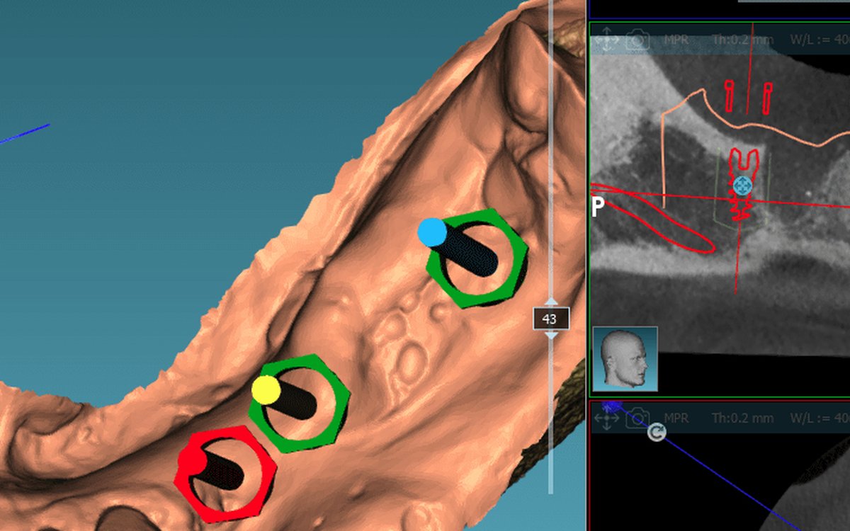 Установка 3DX-Ray CBCT Viewer — КЛКТ и DICOM-просмотр