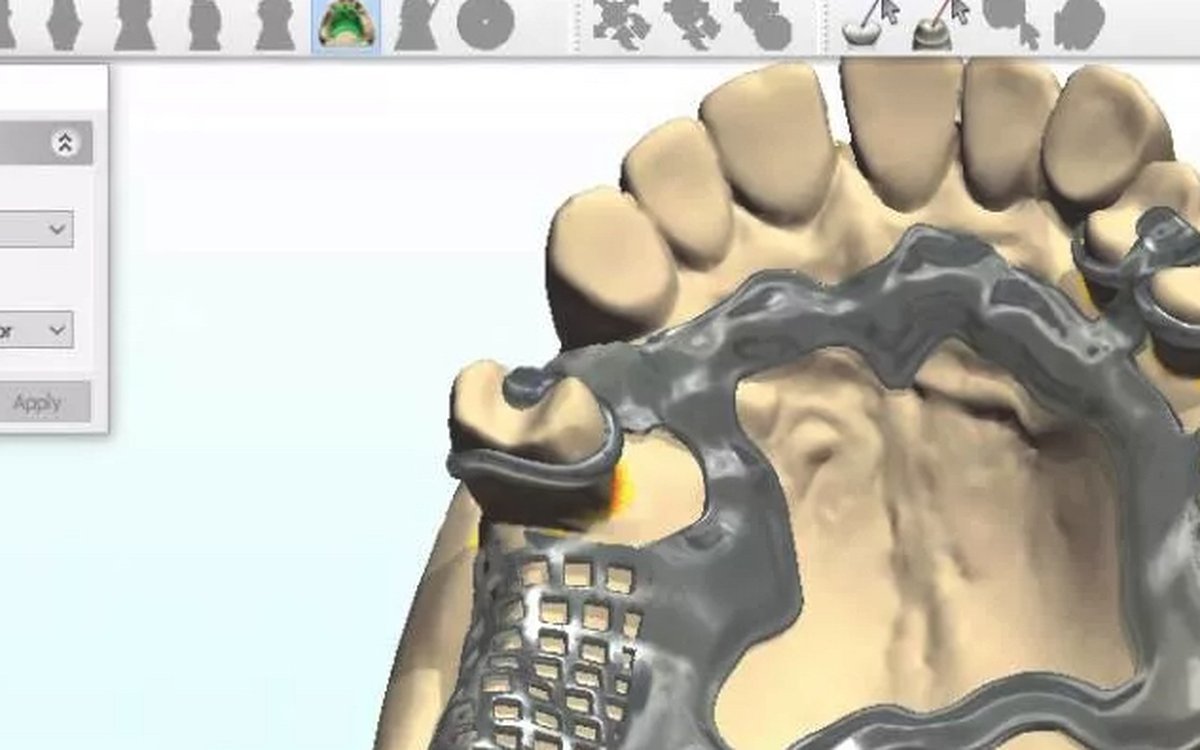 Установка 3Shape Dental System — CAD/CAM системы