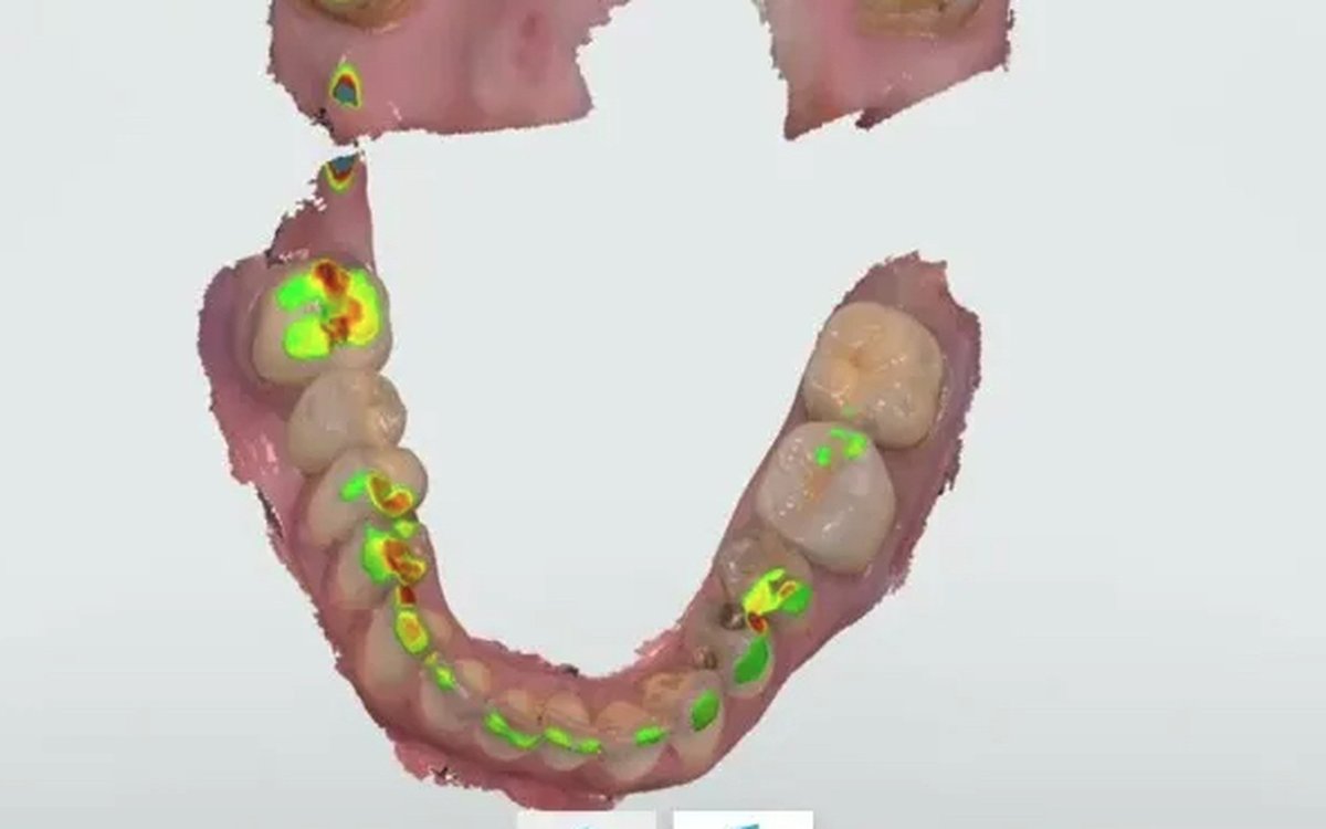 Установка 3Shape TRIOS Software — КЛКТ и DICOM-просмотр
