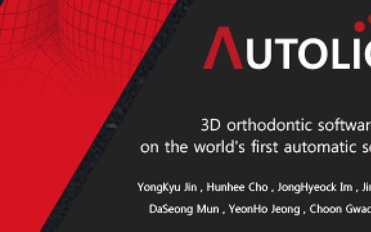 Установка Autolign 3D — Ортодонтия