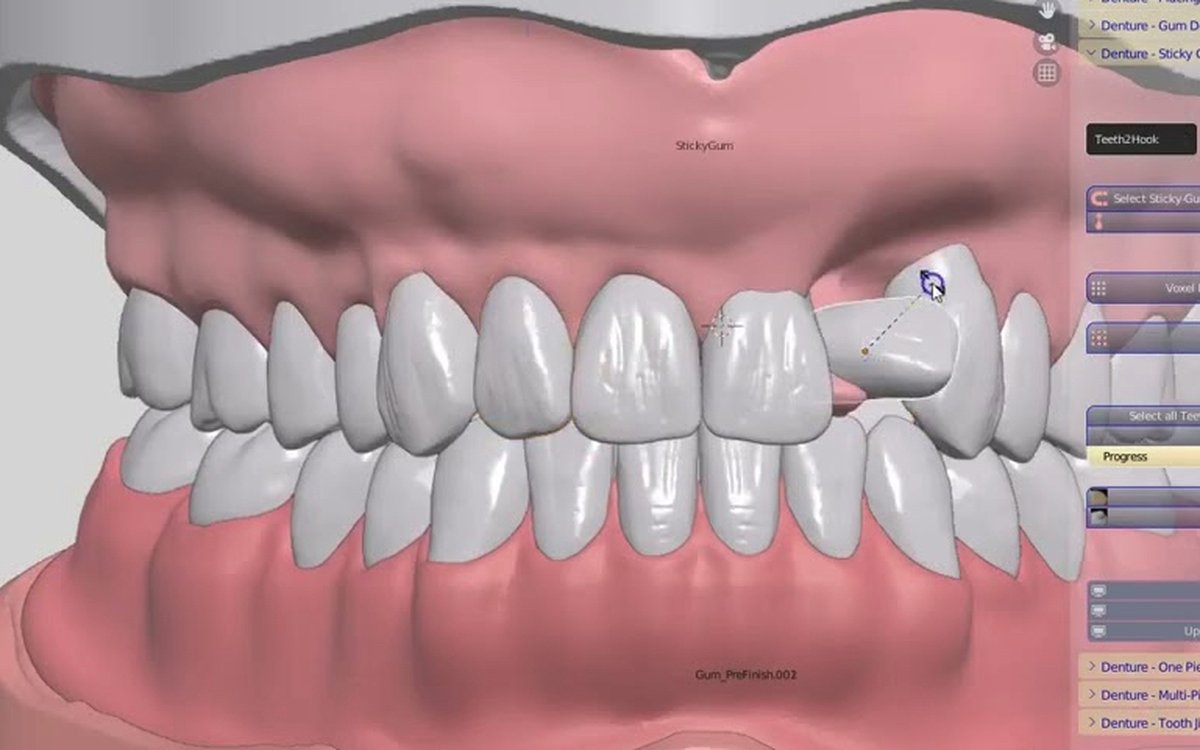 Установка Blender4Dental — CAD/CAM системы