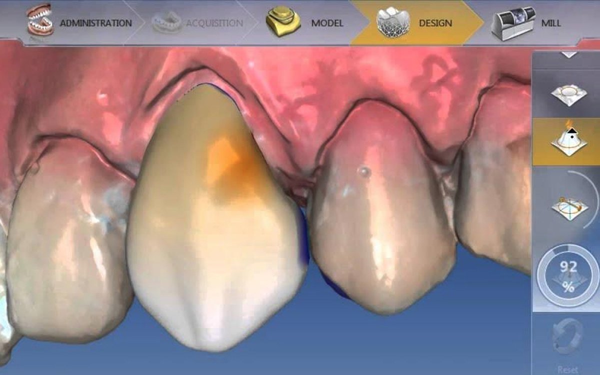 Установка CEREC SW (Dentsply Sirona) — CAD/CAM системы