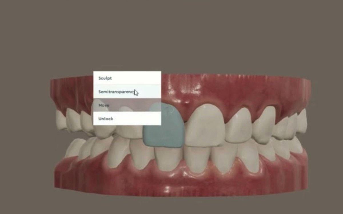 Установка Dental 3DS — CAD/CAM системы