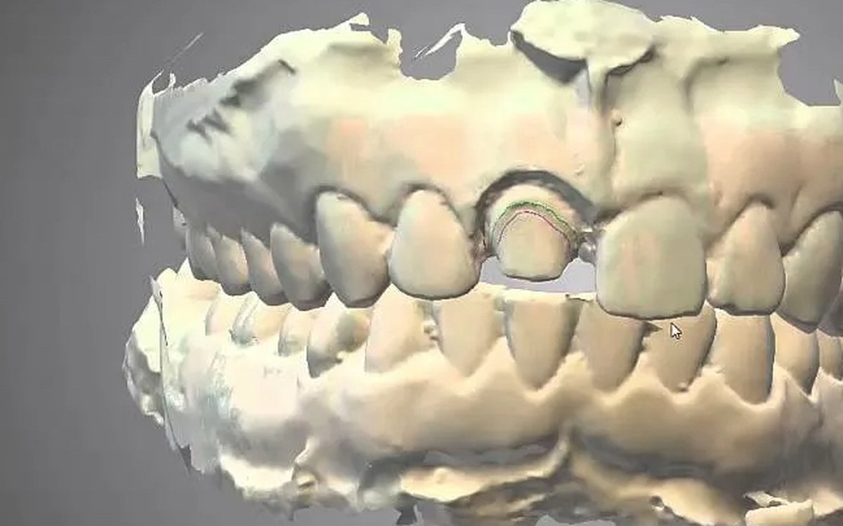 Установка Dental Wings DWOS — CAD/CAM системы