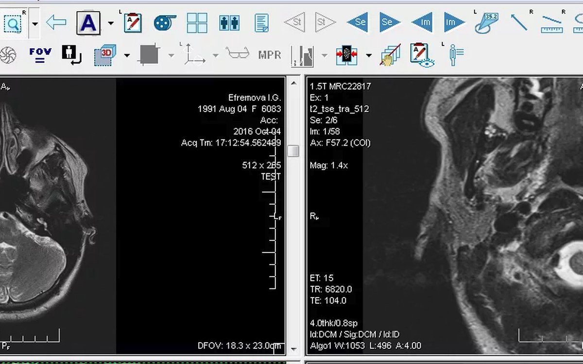 Установка eFilm Workstation — КЛКТ и DICOM-просмотр