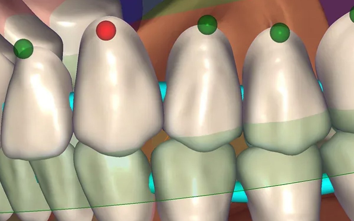 Установка Exocad DentalCAD — CAD/CAM системы