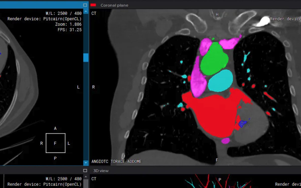 Установка Inobitec DICOM Viewer — КЛКТ и DICOM-просмотр