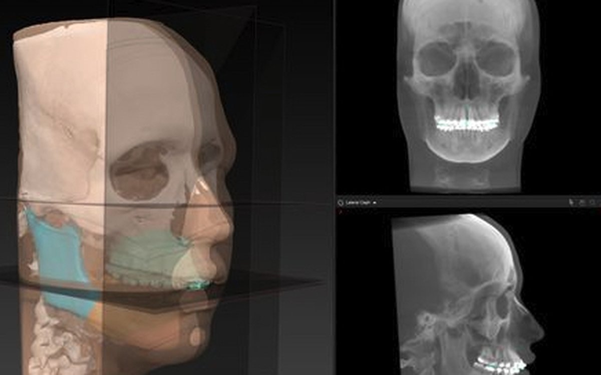 Установка IPS CaseDesigner — CAD/CAM системы