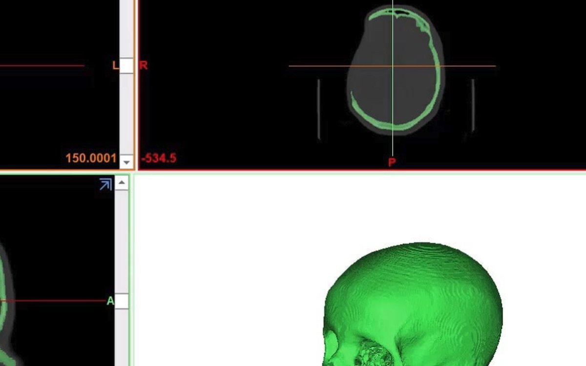 Установка Materialise Mimics — КЛКТ и DICOM-просмотр