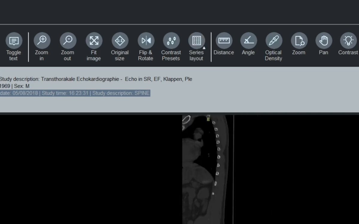 Установка MODALIZER+ — КЛКТ и DICOM-просмотр