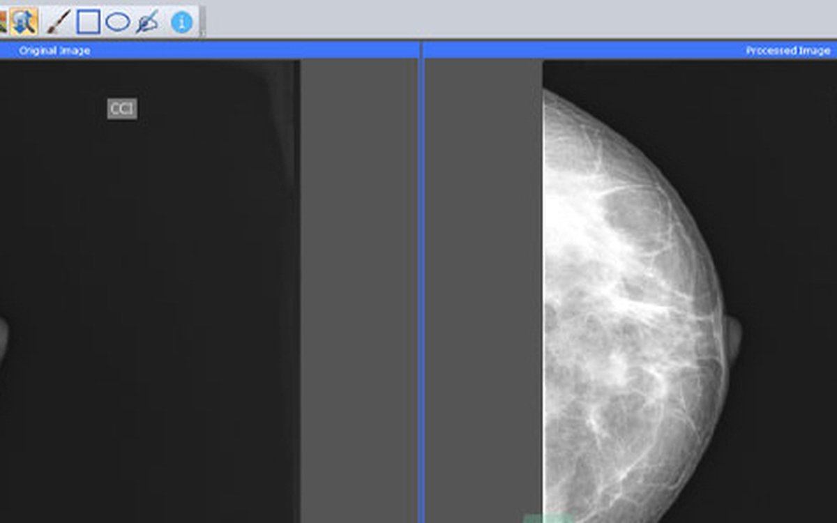 Установка Sante FFT Imaging — КЛКТ и DICOM-просмотр