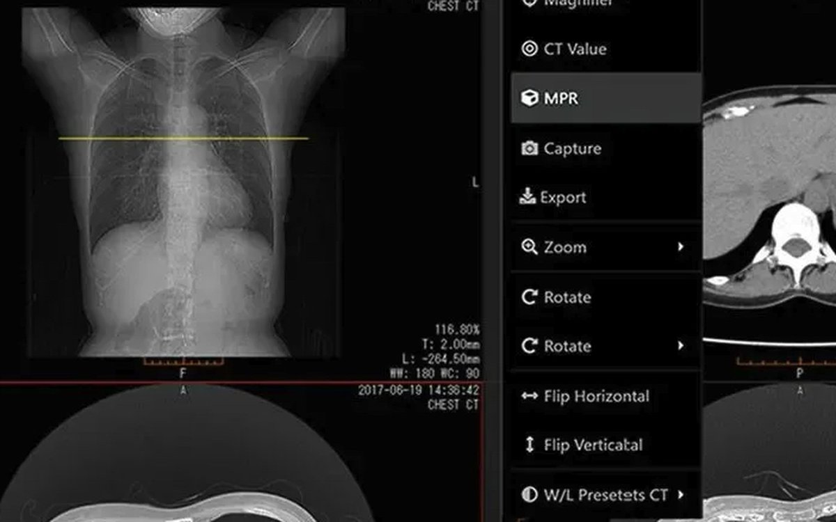 Установка SonicDICOM — КЛКТ и DICOM-просмотр