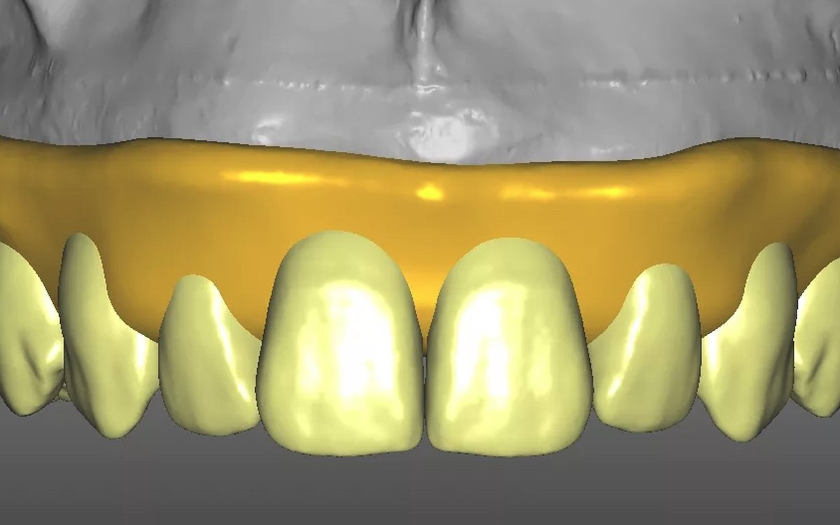 Установка Zirkonzahn.Modellier — CAD/CAM системы
